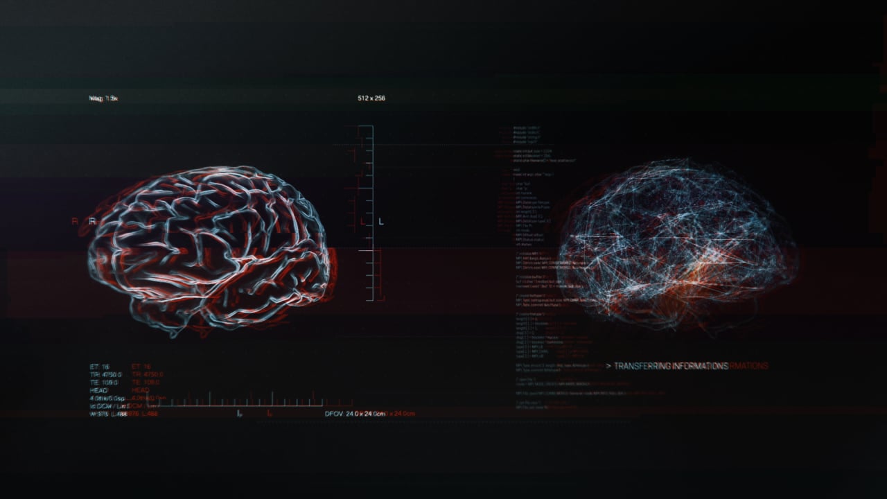 ARTE - The Brain Factory